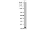 Western Blot analysis of KB cells using Acetyl-Histone H3 (K9) Polyclonal Antibody