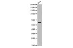 Western Blot analysis of Hela cells using Acetyl-NF?B-p65 (K310) Polyclonal Antibody