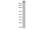 Western Blot analysis of various cells using Acetyl-CBP (K1535) Polyclonal Antibody