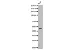 Western Blot analysis of A549 cells using Acetyl-EF-1 a1/2 (K41) Polyclonal Antibody