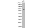 Western Blot analysis of K562 cells using Acetyl-HSP 90 (K292/284) Polyclonal Antibody