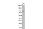 Western Blot analysis of A549 cells using Acetyl-HSP 90 (K435) Polyclonal Antibody