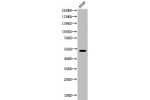 Western Blot analysis of A549 cells using Acetyl-Cytokeratin 8 (K483) Polyclonal Antibody