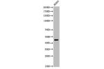 Western Blot analysis of AD293 cells using Acetyl-p53 (K370) Polyclonal Antibody