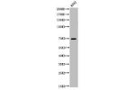 Western Blot analysis of K562 cells using Acetyl-p73 (K321) Polyclonal Antibody