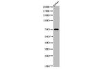 Western Blot analysis of JK cells using Acetyl-p73 (K327) Polyclonal Antibody