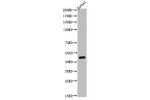 Western Blot analysis of JK cells using Acetyl-Tubulin a (K40) Polyclonal Antibody