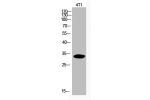 Western Blot analysis of 4T1 cells using Acetyl-p57 (K278) Polyclonal Antibody