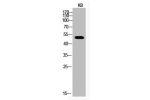 Western Blot analysis of KB cells using Acetyl-p53 (K373) Polyclonal Antibody