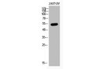 Western Blot analysis of 293T-UV cells using Acetyl-p53 (K382) Polyclonal Antibody
