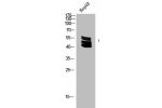 Western Blot analysis of HEPG2 cells using Acetyl-Ub (K27) Polyclonal Antibody