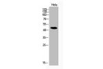 Western Blot analysis of Hela cells using Acetyl-NF?B-p65 (K314/K315) Polyclonal Antibody