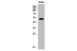 Western Blot analysis of SKW3 cells using Acetyl-p53 (K320) Polyclonal Antibody