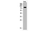 Western Blot analysis of Hela cells using Acetyl-Ub (K33) Polyclonal Antibody