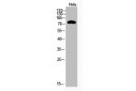Western Blot analysis of Hela cells using Acetyl-Ub (K48) Polyclonal Antibody