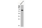 Western Blot analysis of HEPG2-UV cells using Acetyl-Cortactin (K235) Polyclonal Antibody