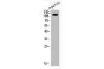 Western Blot analysis of HEPG2-UV cells using Acetyl-CRM1 (K568) Polyclonal Antibody