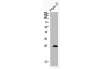 Western Blot analysis of HEPG2-UV cells using Acetyl-HMG-1 (K12) Polyclonal Antibody