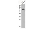 Western Blot analysis of RAT-kidney cells using Acetyl-HSP70 (K246) Polyclonal Antibody