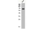 Western Blot analysis of A549 cells using Acetyl-Nrf2 (K599) Polyclonal Antibody