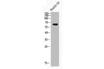 Western Blot analysis of HEPG2-UV cells using Acetyl-NF?B-p65 (K122) Polyclonal Antibody