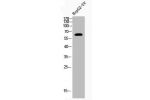 Western Blot analysis of HEPG2-UV cells using Acetyl-NF?B-p65 (K221) Polyclonal Antibody