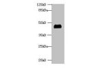 Western blot<br />
All lanes:Fructose-bisphosphate aldolase A polyclonal Antibody at 2ug/ml+EC109 whole cell lysate<br />
Secondary<br />
Goat polyclonal to Rabbit IgG at 1/15000 dilution<br />
Predicted band size: 40,46 kDa<br />
Observed band size: 40 k