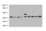 Western blot<br />
All lanes: Glyceraldehyde-3-phosphate dehydrogenase antibody at 2ug/ml<br />
Lane 1: Hale whole cell lysate<br />
Lane 2: A549 whole cell lysate<br />
Lane 3: HepG2 whole cell lysate<br />
Lane 4: K562 whole cell lysate<br />
Lane 5: Ju