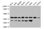 Western Blot<br />
Positive WB detected in:Hela whole cell lysate,A549 whole cell lysate,HEK293 whole cell lysate,HepG2 whole cell lysate,Jurkat whole cell lysate,K562 whole cell lysate,Mouse liver tissue,Mouse kidney tissue<br />
All lanes: GAPDH antibod