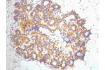 IHC staining of Human ovary tissue, diluted at 1:200.