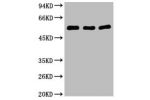 Western blot analysis of 1) Hela, 2) Mouse Brain, 3) HepG2, diluted at 1:2000.