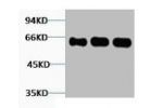 Western blot analysis of 1) Hela, 2) Mouse Brain, 3) Rat Brain tissue, diluted at 1:2000.