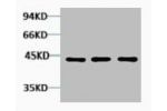Western blot analysis of 1) Hela, 2) 3T3, 3) Rat Kidney tissue, diluted at 1:2000.