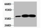 Western blot analysis of 1) Hela, 2) Mouse Brain, 3) Rat Brain tissue, diluted at 1:3000.