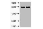 Western blot analysis of Bovine Serum Albumin, Rabbit pAb diluted at  1) 1:2000  2) 1:5000