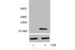 Western blot analysis of extracts from Hela cells, untreated (-) or treated, 1:2000.