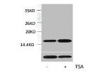 Western blot analysis of extracts from Hela cells, untreated (-) or treated, 1:2000.