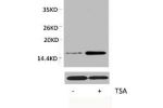Western blot analysis of extracts from Hela cells, untreated (-) or treated, 1:2000.