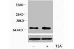 Western blot analysis of extracts from Hela cells, untreated (-) or treated, 1:2000.