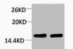 Western blot analysis of 1) Hela, 2) 3T3, diluted at 1:2000.