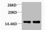 Western blot analysis of 1) Hela, 2) 3T3, diluted at 1:2000.