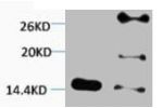 Western blot analysis of 1) Hela, 2) 3T3, diluted at 1:2000.