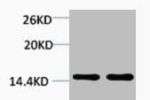 Western blot analysis of 1) Hela, 2) 3T3, diluted at 1:2000.