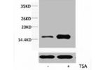 Western blot analysis of extracts from Hela cells, untreated (-) or treated, 1:2000.