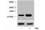 Western blot analysis of extracts from Hela cells, untreated (-) or treated, 1:5000.