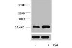 Western blot analysis of extracts from Hela cells, untreated (-) or treated, 1:5000.