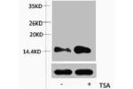 Western blot analysis of extracts from Hela cells, untreated (-) or treated, 1:5000.