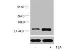 Western blot analysis of extracts from Hela cells, untreated (-) or treated, 1:5000.