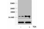 Western blot analysis of extracts from Hela cells, untreated (-) or treated, 1:5000.