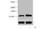 Western blot analysis of extracts from Hela cells, untreated (-) or treated, 1:5000.